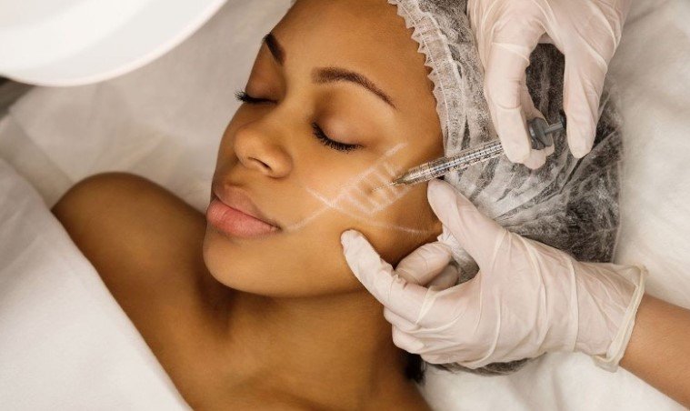 Is Botox worth it in your 30s — SNA Aesthetics Brooklyn
