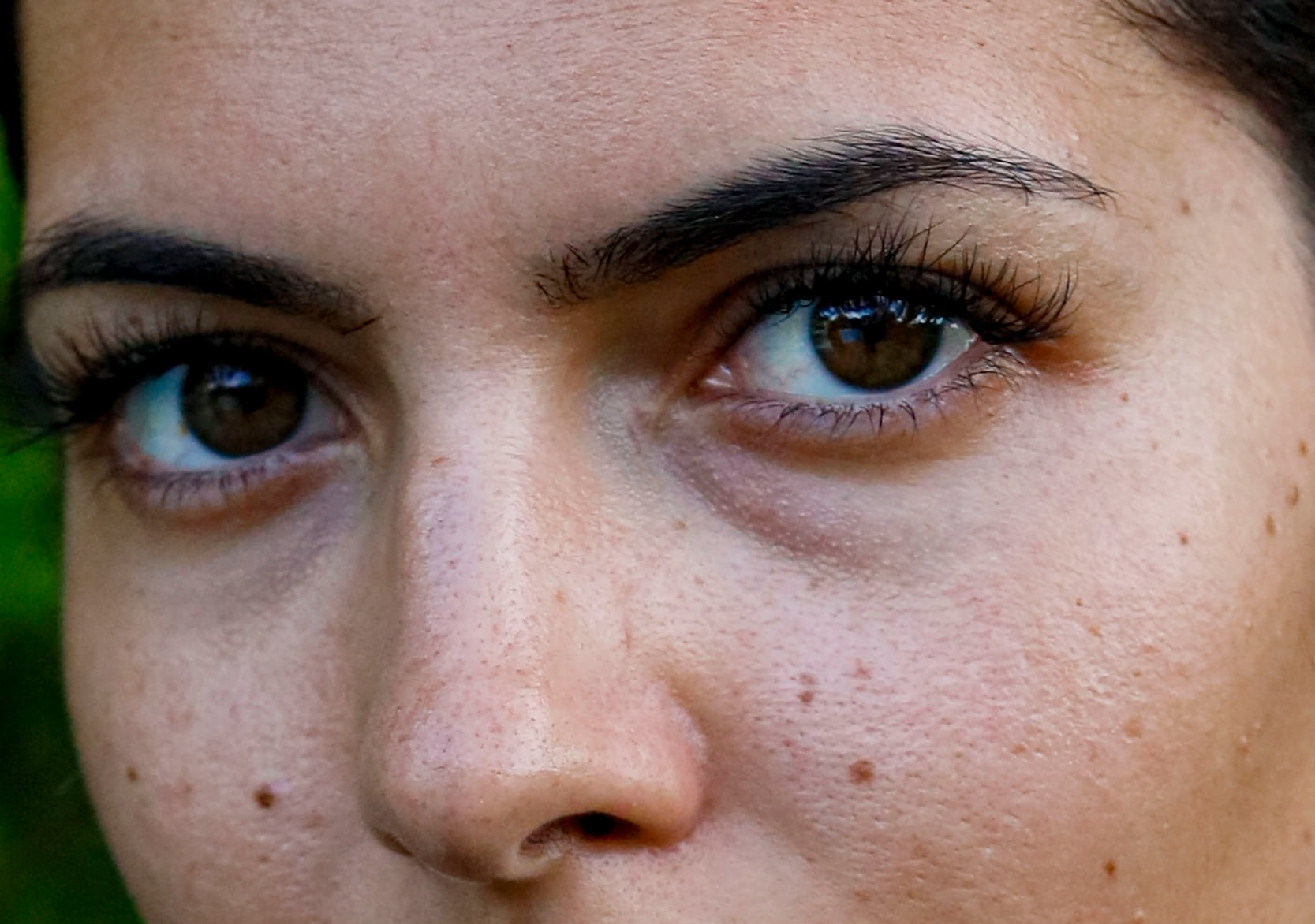 Forma RF treatment Brooklyn — SNA Aesthetics
