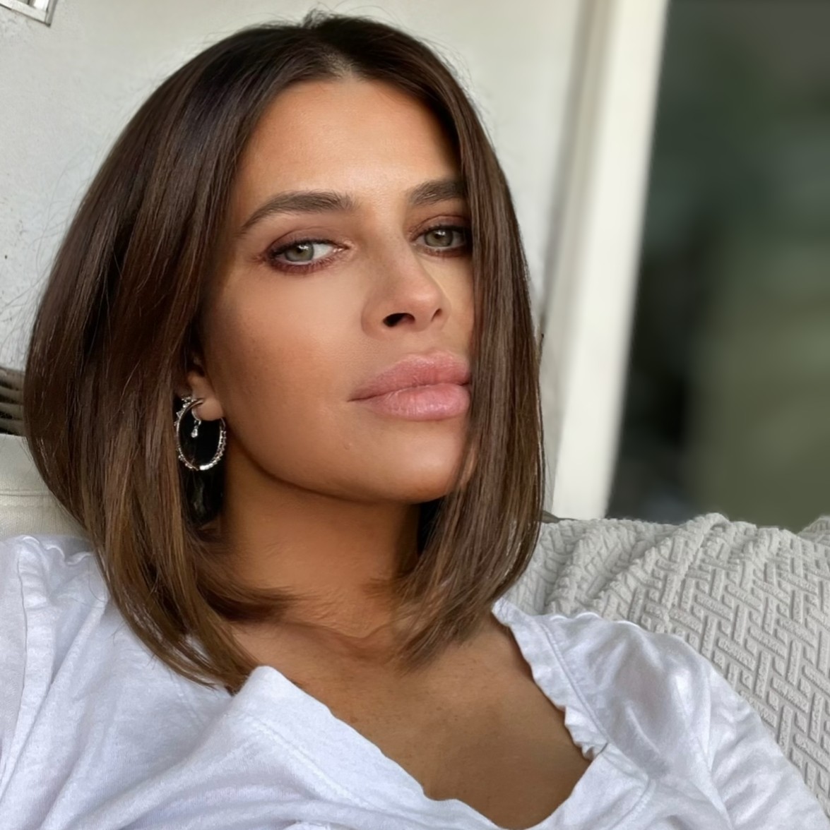 Full Face Rejuvenation result — SNA Aesthetics Brooklyn