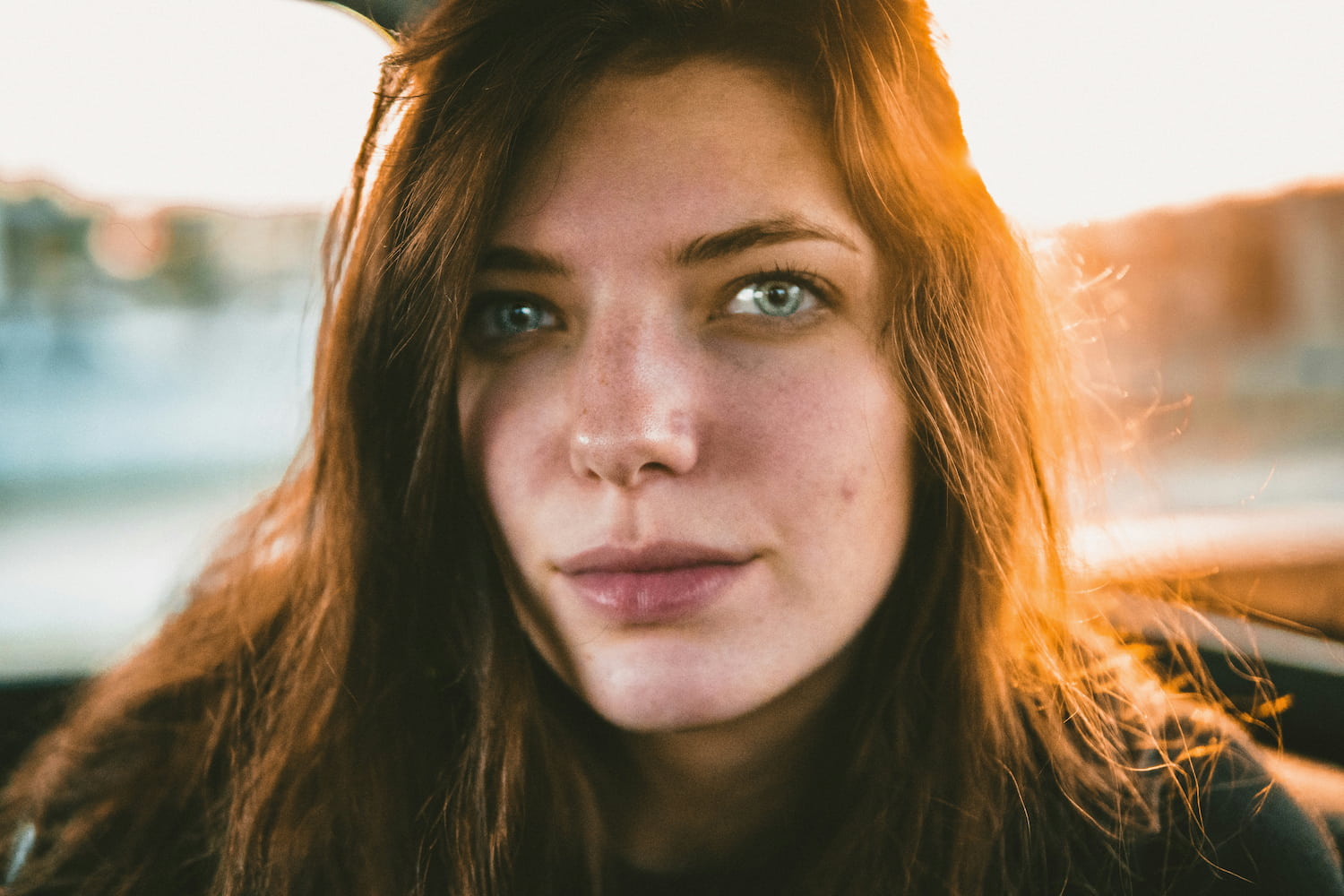 Vasculaze vascular laser Brooklyn — SNA Aesthetics